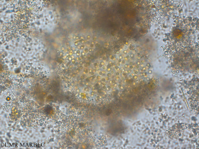 phyto/Pertuis Charentais/Tasdon_st7/PAMPAS 2019-2021/Microcystis sp2 (TASDON_St7_0419 -1).tif(copy)_thumb.jpg